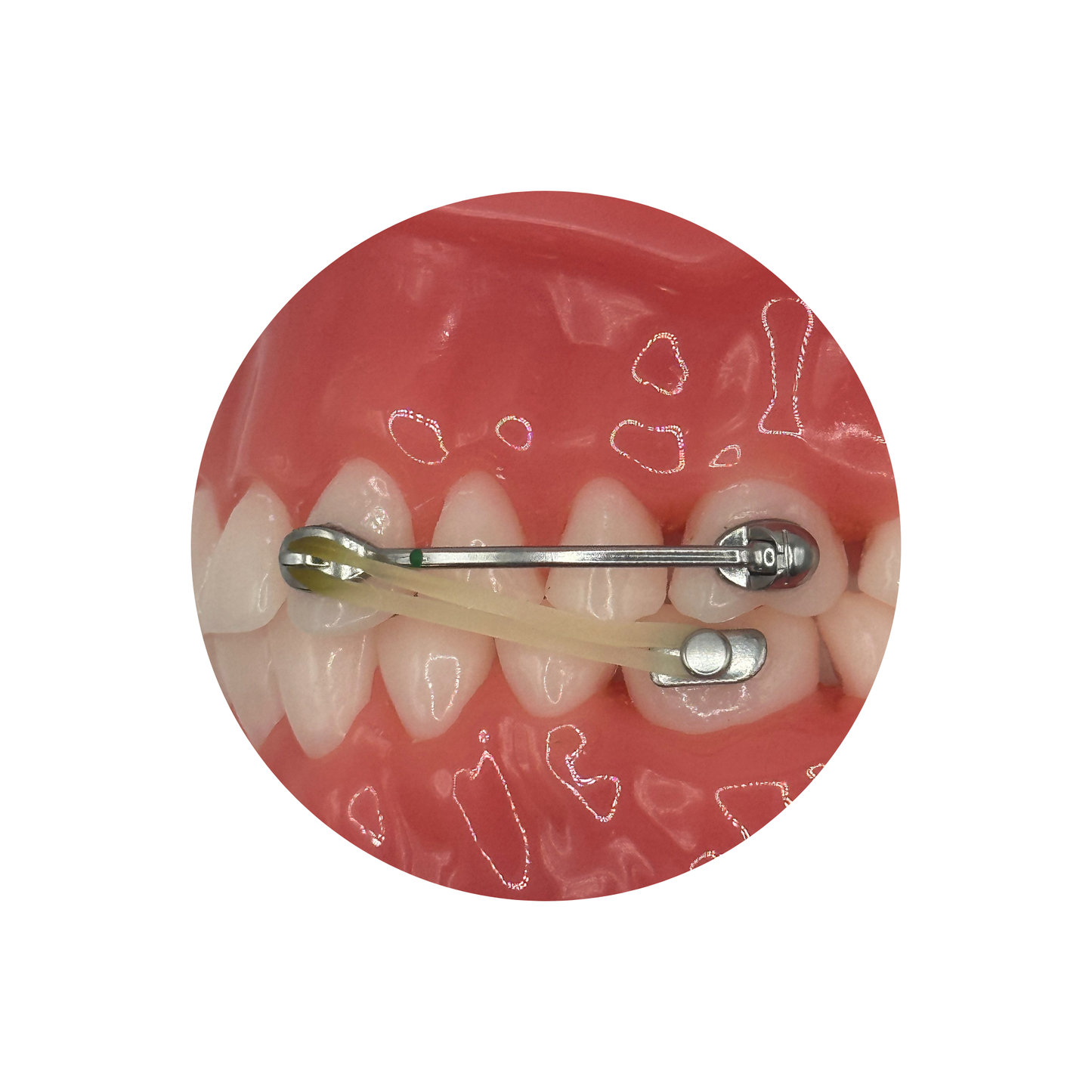 DMD Appliance Elastics