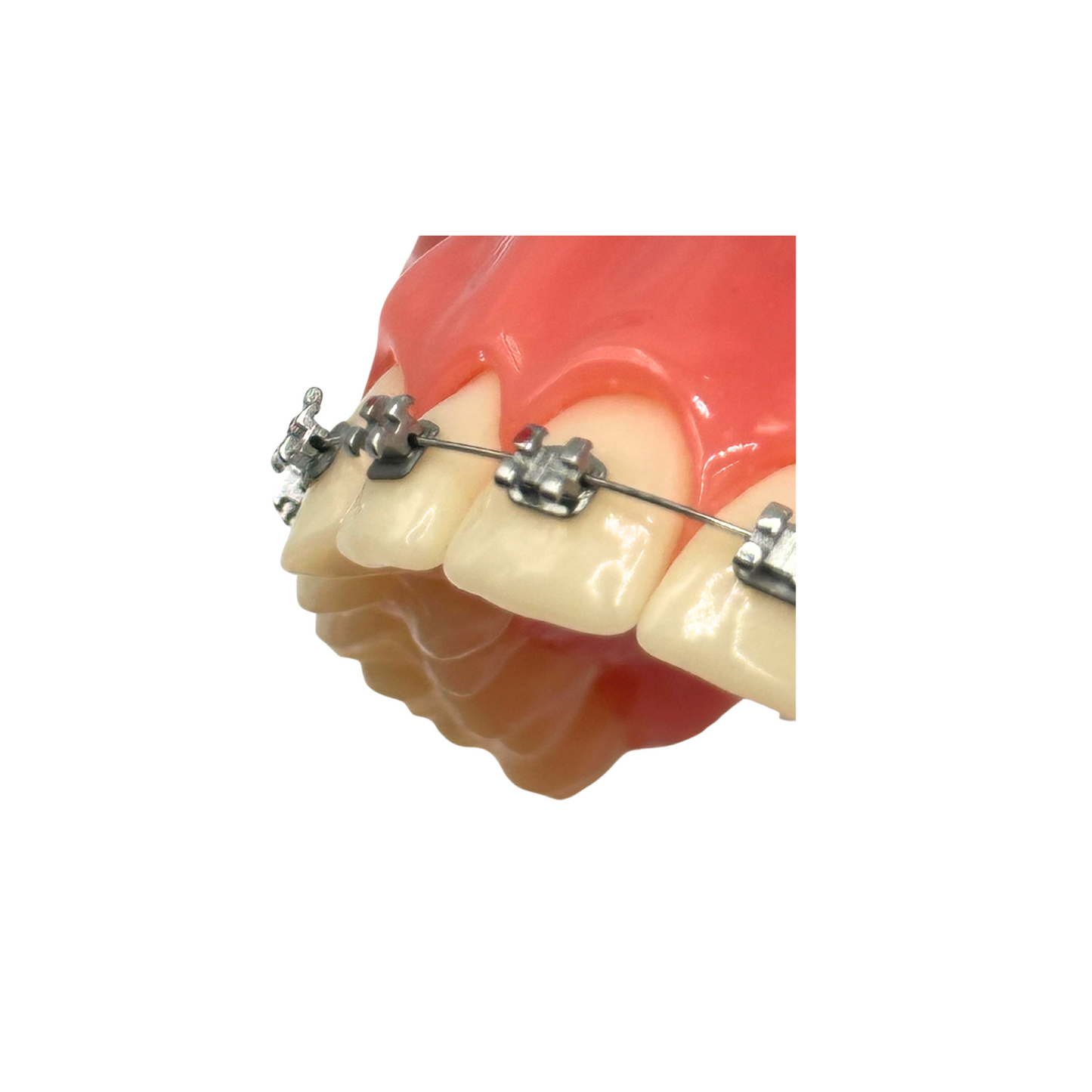 Lucchesi-Sub-Slot-Brackets-Typodont-Dental-Orthodontic-Teeth-Model