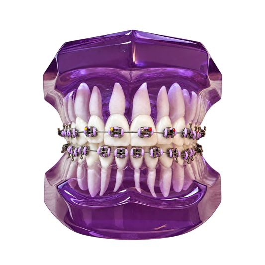 Transparent-Purple-Dental-Model-Typodont-With-Twin-Brackets-Braces-Front