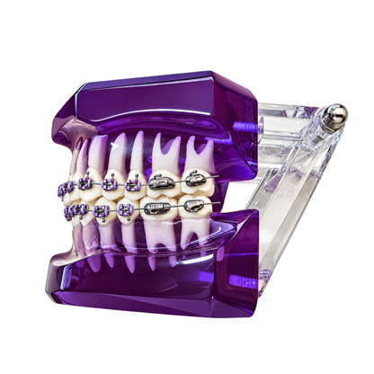 Transparent-Purple-Dental-Model-Typodont-With-Twin-Brackets-Braces-Side