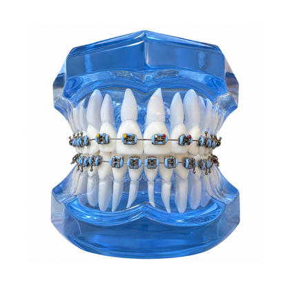 Transparent-Blue-Dental-Model-Typodont-With-Twin-Brackets-Braces-Front
